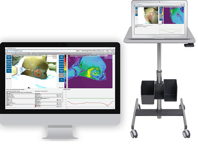 WoundVision Scout Solutions