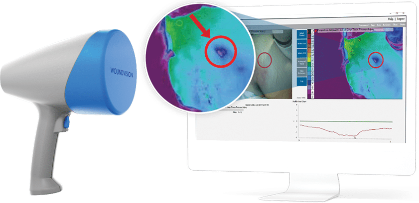 Wound Imaging and Documentation Solutions