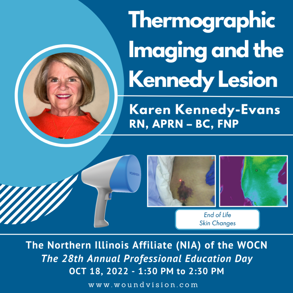 Thermography Kennedy Terminal Ulcer